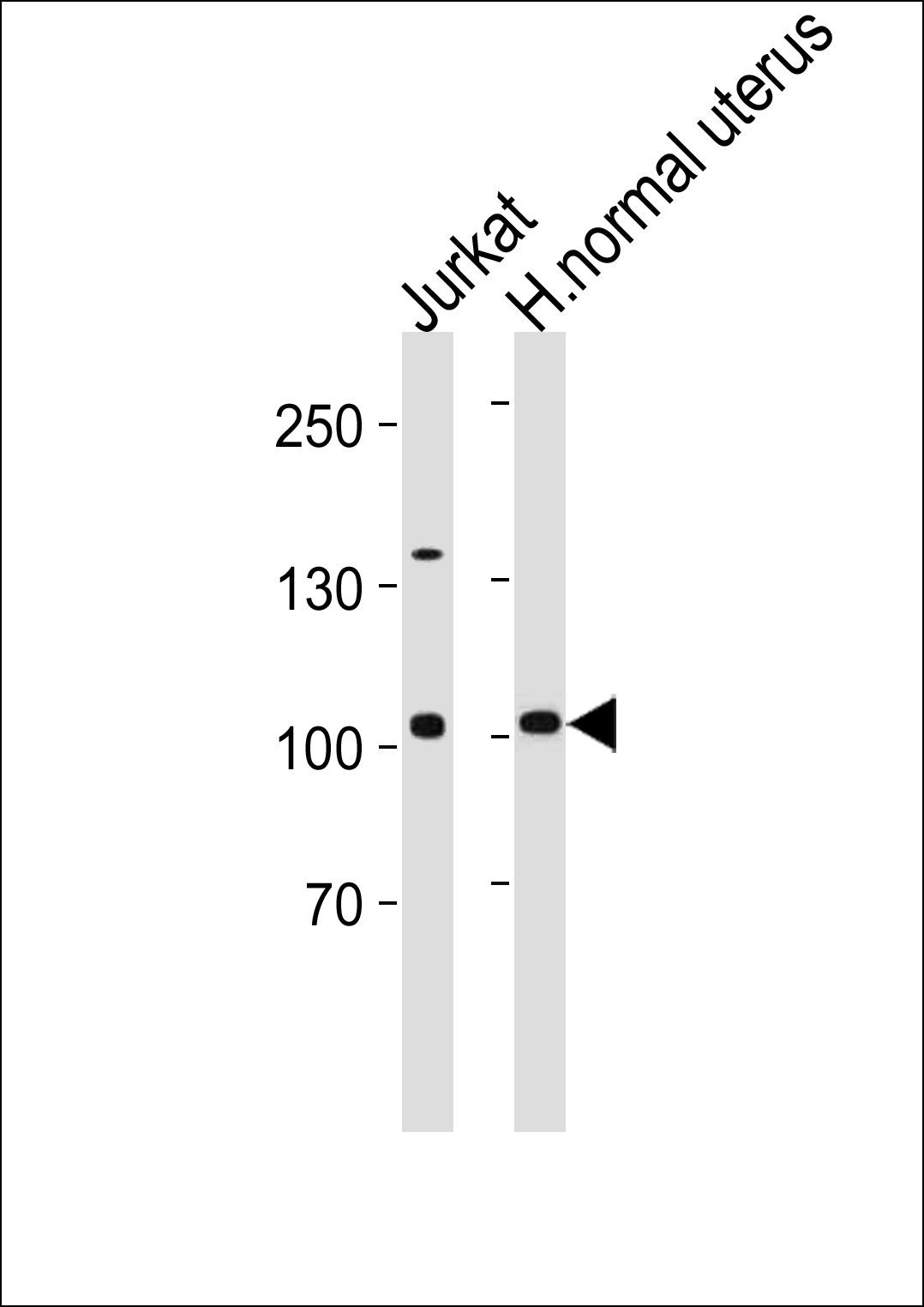  ABIN2504374 TBK1 antibody Antibodypedia