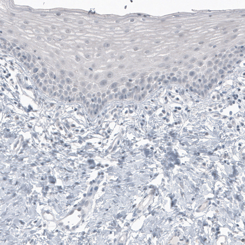  AMAb91318 Atlas Antibodies CT83 antibody Antibodypedia