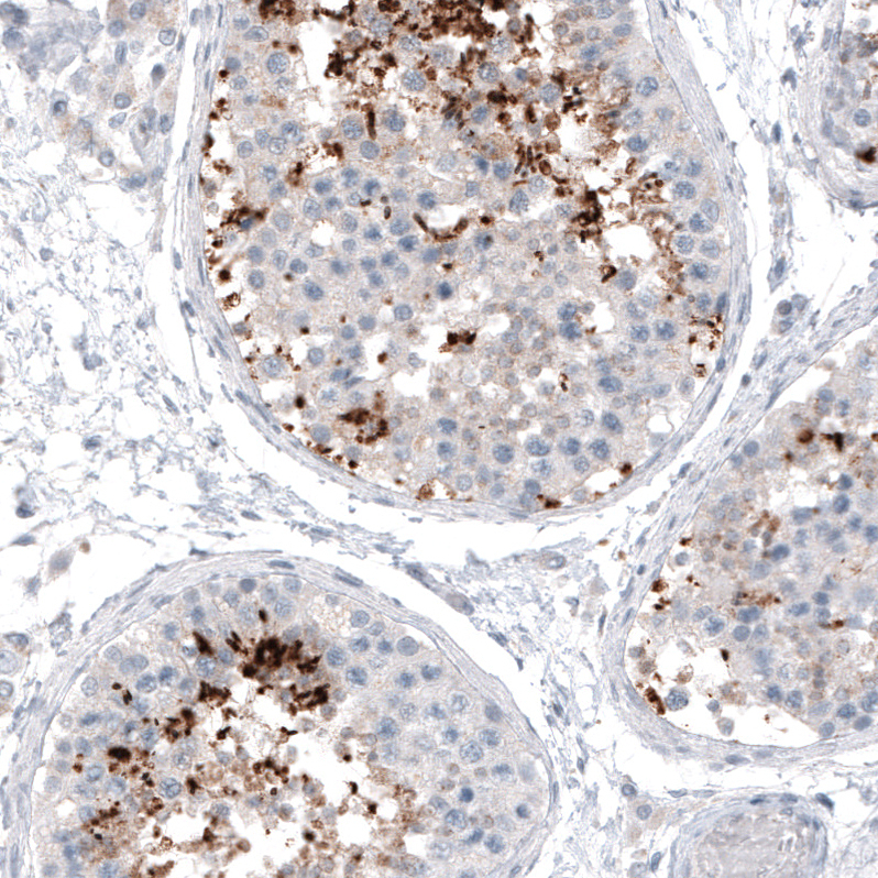  AMAb91318 Atlas Antibodies CT83 antibody Antibodypedia