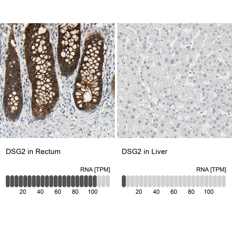  HPA004896 Atlas Antibodies DSG2 antibody Antibodypedia
