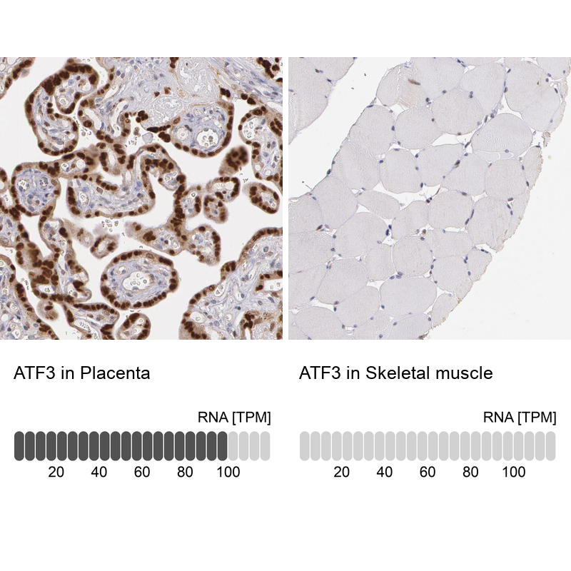  HPA001562 Atlas Antibodies ATF3 antibody Antibodypedia