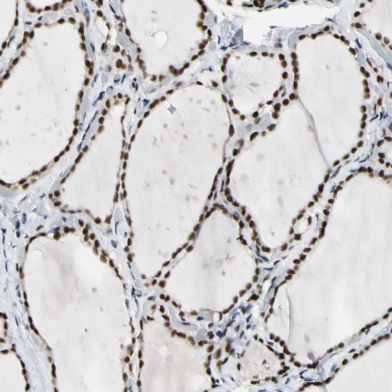  HPA008884 Atlas Antibodies NFIA antibody Antibodypedia