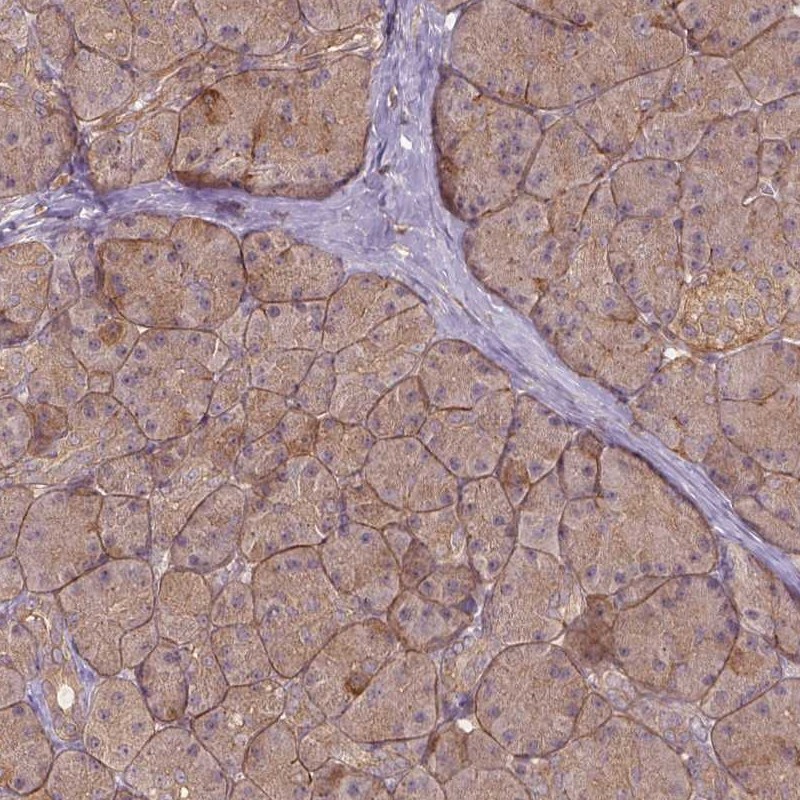  HPA016557 Atlas Antibodies XPR1 antibody Antibodypedia