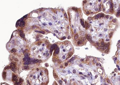 - LS-C801014 - LSBio FGFR1 antibody | Antibodypedia