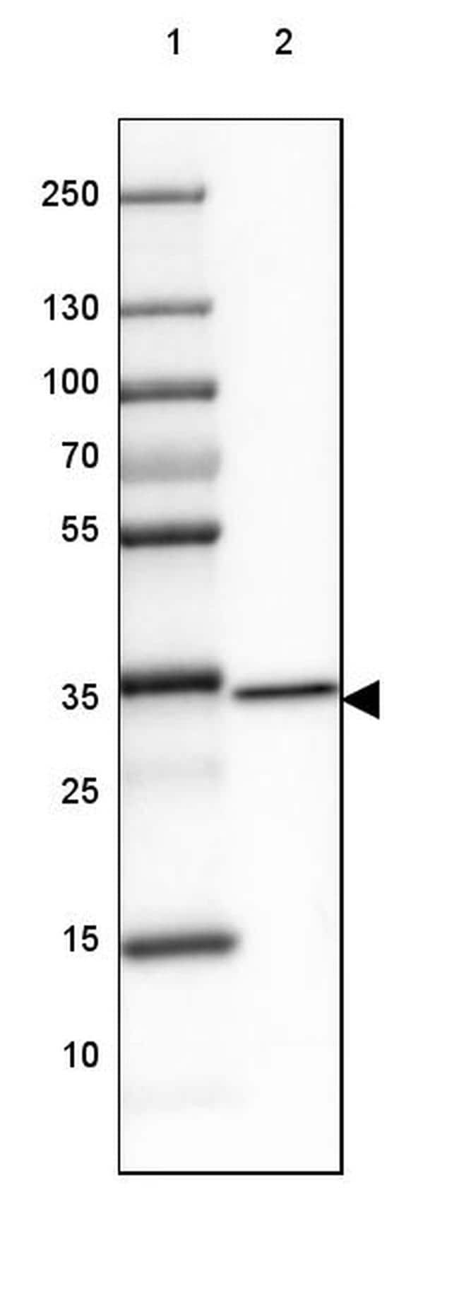 PA559581 Invitrogen Antibodies GDPD3 antibody Antibodypedia